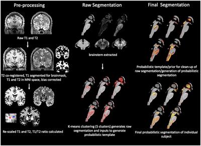 Mapping internal brainstem structures using T1 and T2 weighted 3T images